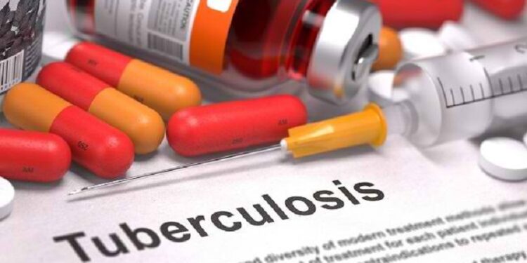 Pelaksanaan Penanganan TBC di Bukittinggi Dievaluasi