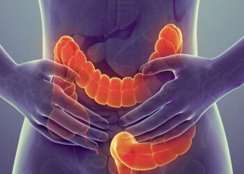 Kanker Usus Makin Menyerang Usia Muda, Studi Ungkap Peran Makanan Ultraolahan