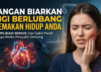 Waspada, Membiarkan Gigi Berlubang Tanpa Penanganan Bisa Memicu Komplikasi Medis yang Serius